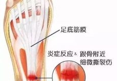 记者：足底筋膜炎恢复缓慢，法蒂可能缺席三周或超过一个半月