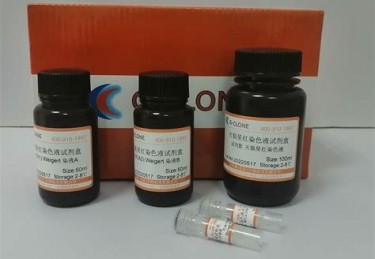 天狼星VS索尔纳结果